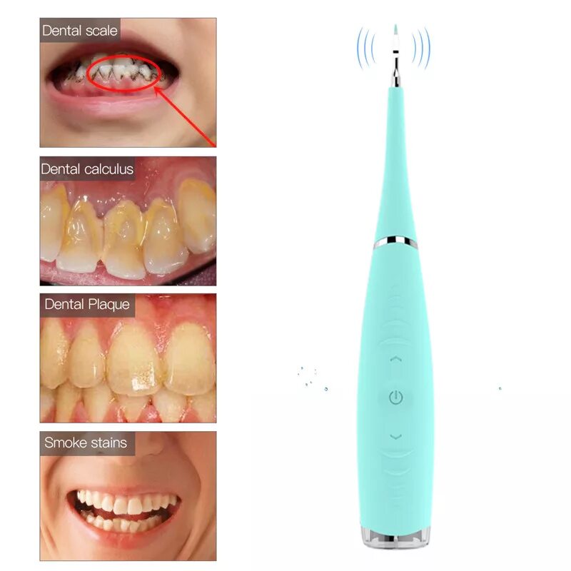 Ultrasonic Tooth Cleaner скалер. Скалер от зубного камня. Зубная щетка Dental Calculus Remover. Электрический звуковой стоматологический скалер.