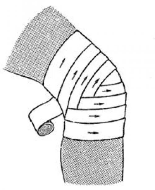 Черепашья сходящаяся перевязка на колено. Черепашья сходящаяся на коленный сустав. Сходящаяся черепашья повязка. Черепашья бинтовая повязка. Как перевязывать колено