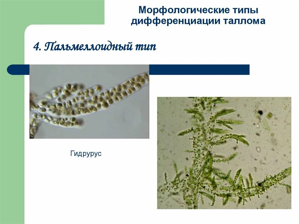 Таллом водоросли кладофора. Монадный таллом. Типы талломов водорослей. Нитчатый таллом улотрикс. Сифональный тип дифференциации таллома.