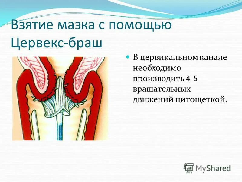 Материал из цервикального канала