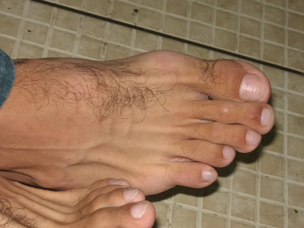 Hairy foot. Feet men 45 лет. Feet men бугаи. Латино man feet.