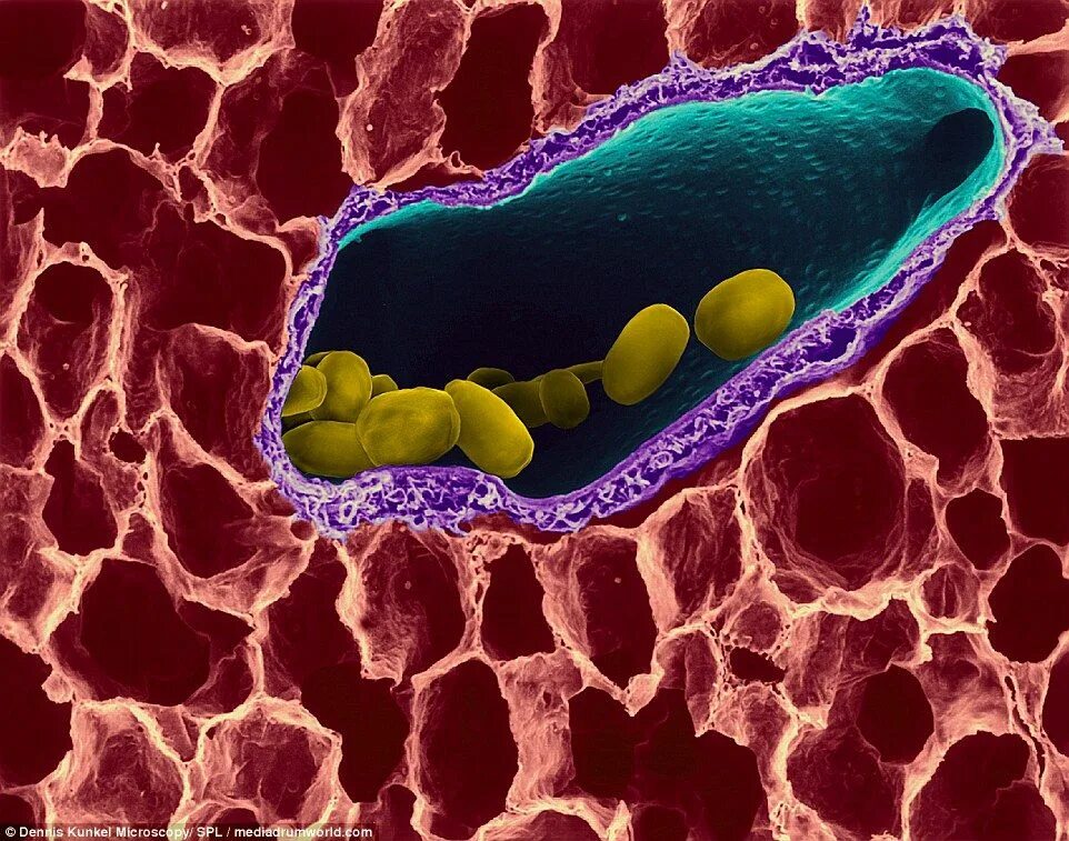 Бациллус антрацис споры. Bacillus anthracis Сибирская язва. Сибиреязвенные бациллы споры. Клетка язвы