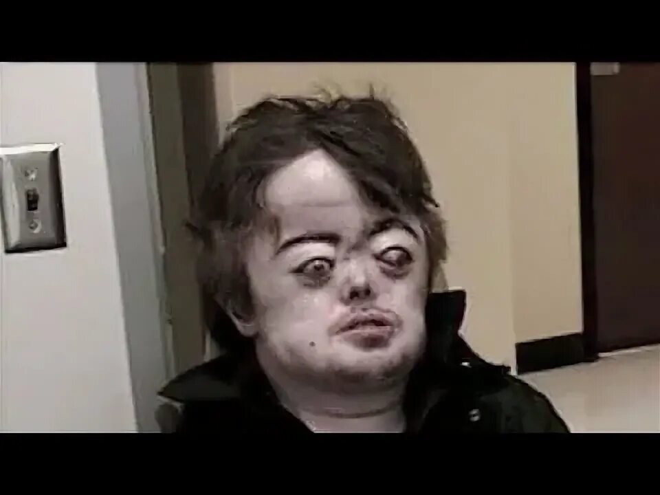 Brain peppers история