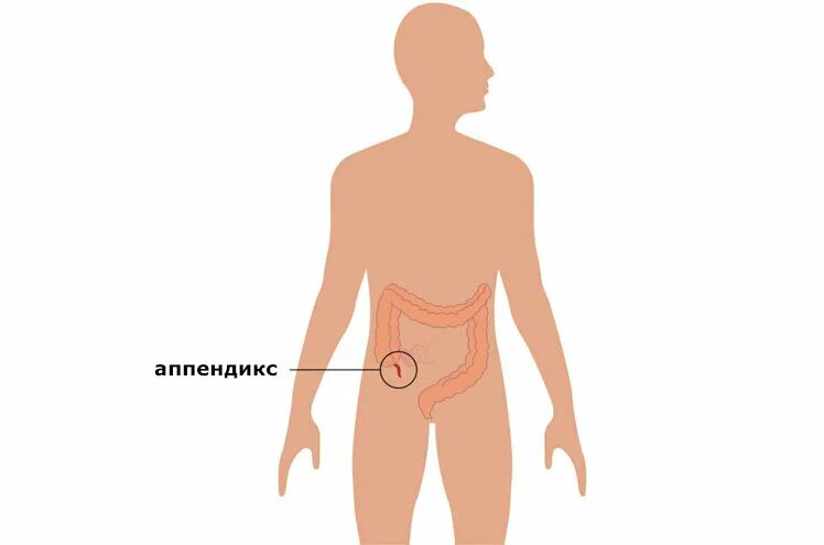 Функция аппендицита. Зачем нужен аппендицит. Аппендикс иммунная система. Аппендикс орган иммунной системы.