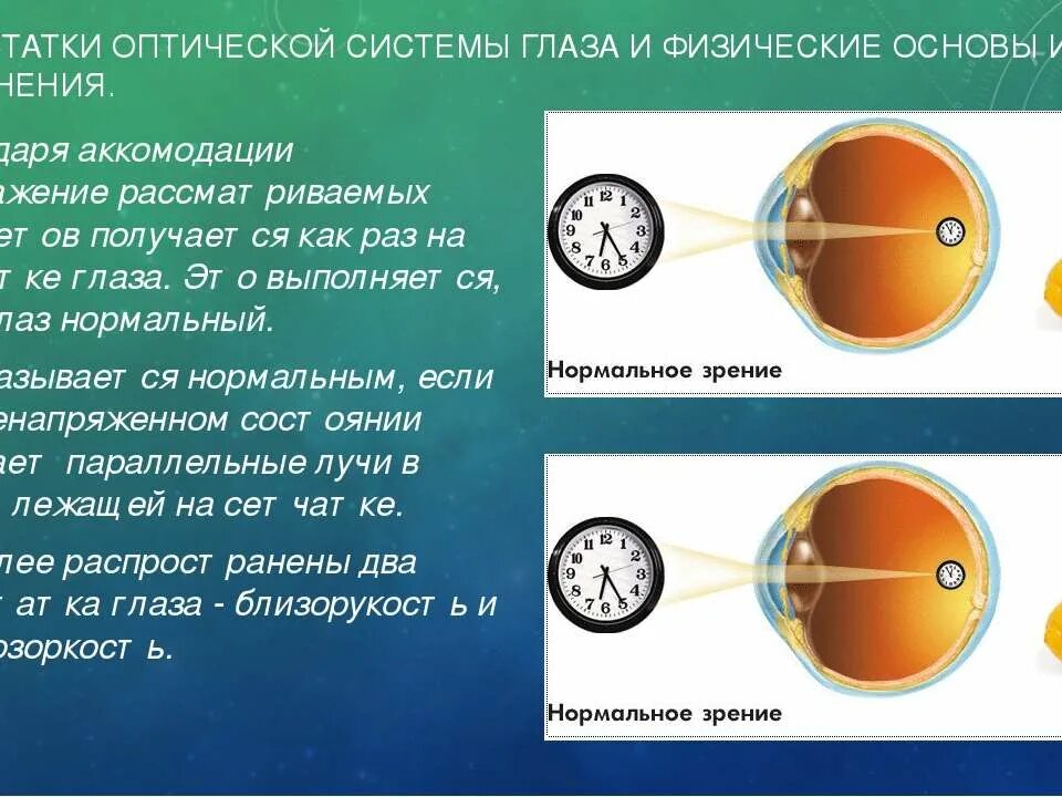 Недостатки оптической системы глаза. Недостатки оптической системы глаза и их коррекция физика. Строение глаза оптическая система глаза. Дефекты зрения.