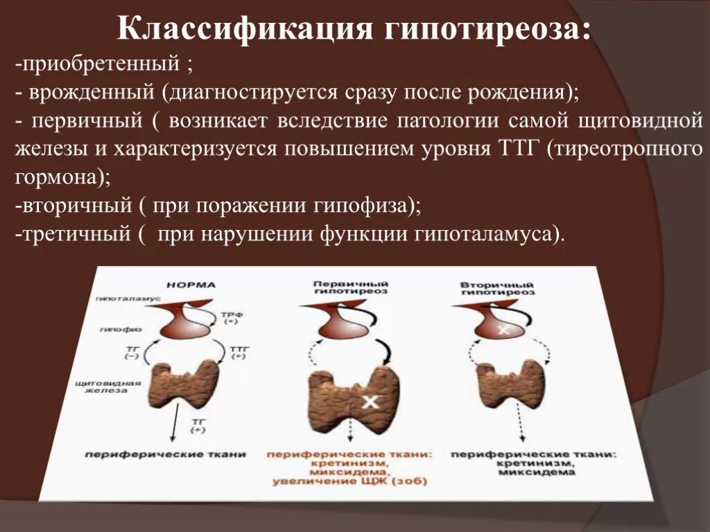 Классификация гипофункции щитовидной железы. Классификация первичного гипотиреоза. Классификация врожденогогипотиреоза. Классификация гипотиреоза по степени тяжести. Типы гипотиреоза