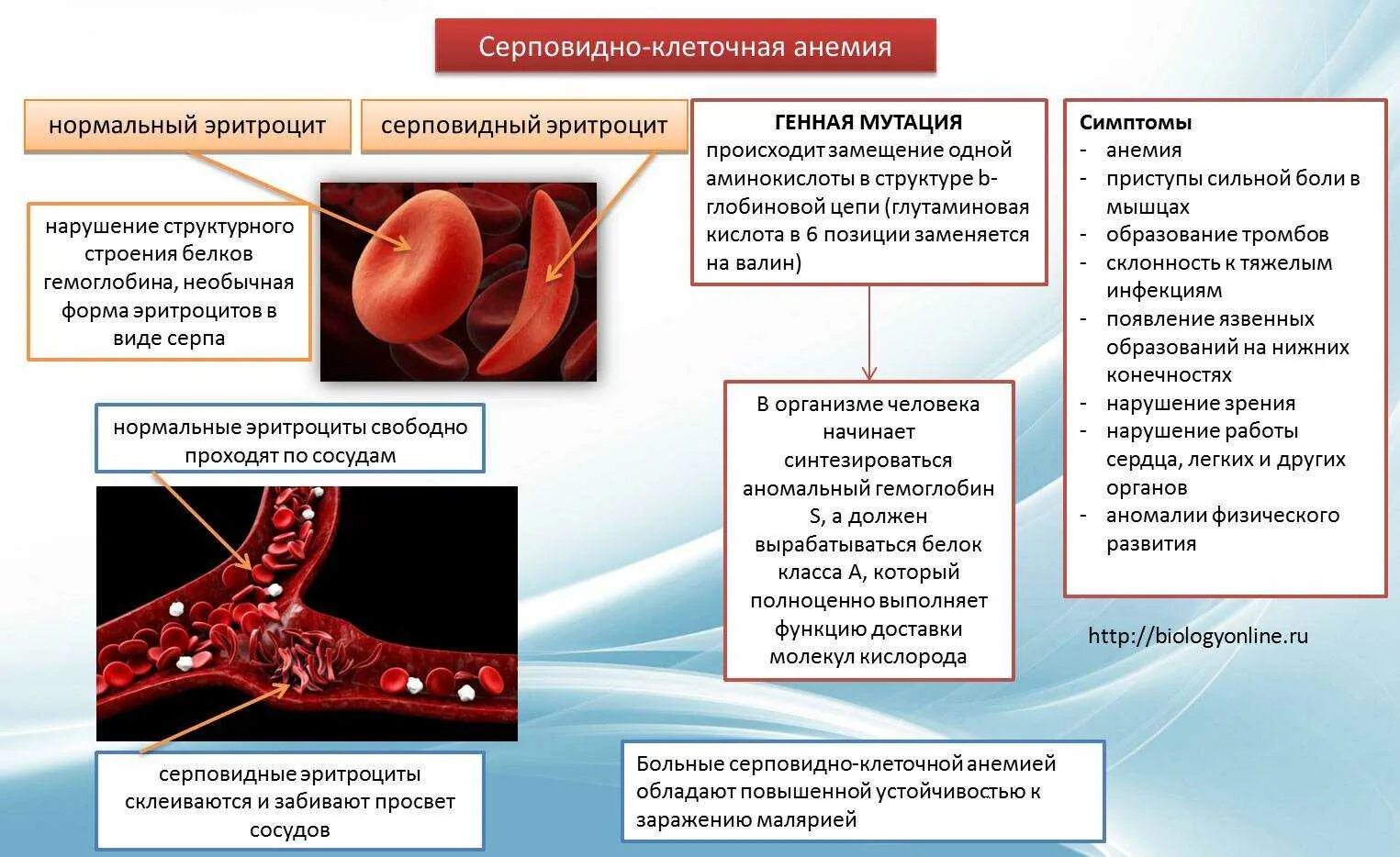 Серповидно клеточная анемия признаки. Гемоглобин серповидноклеточная анемия. При серповидно-клеточной анемии гемоглобин:. Гемоглобин s при серповидноклеточной анемии. Серповидноклеточная анемия эритроциты.