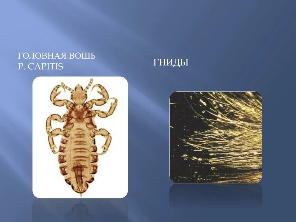 Человеческая головная вошь Pediculus humanus capitis. Головная вошь - Pediculus capitis. Гнида головной вши