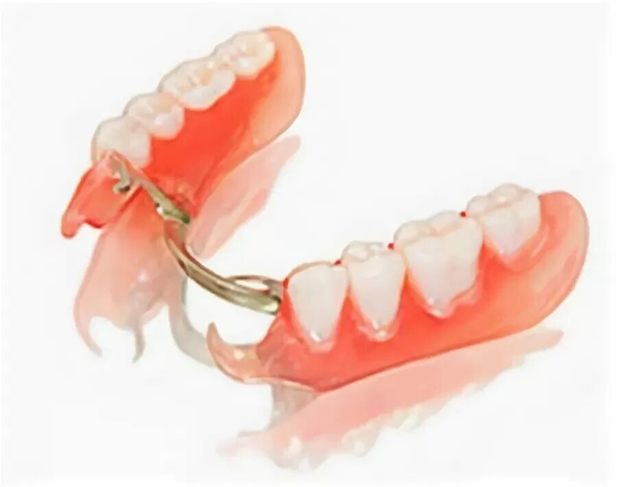 комбинированных мостовидных протезов. мостовидные протезы металл цельнолитые. интерлок бюгельный протез. комбинированные зубные протезы. металлоакриловый мостовидный протез.