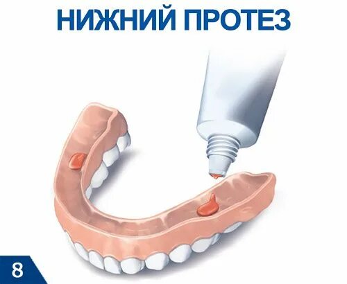 Как правильно наносить крем на зубные протезы. Протезы для зубов на кореге. съемные протезы на кореге. зубные протезы на кореге. нанесение фиксирующего крема на зубной протез.