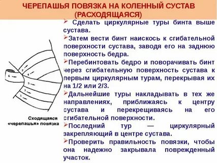 Сходящаяся и расходящаяся повязка