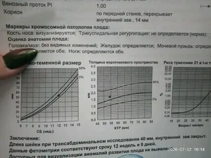 Предлежание хориона на 12 неделе беременности
