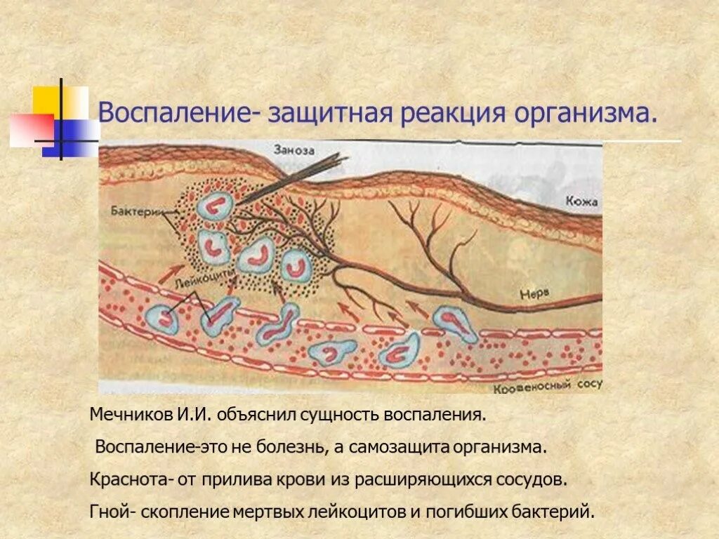 Воспалительный процесс. Нейровоспалительный процесс. Воспалительный процесс рисунок. Болезнь реакция организма