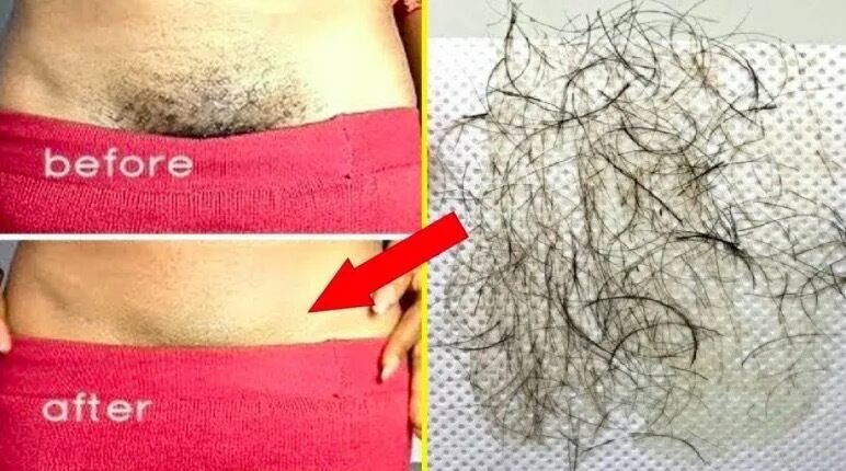 Depilação com Cera de curcuma Caseira Regiao Intima virilha - YouTube