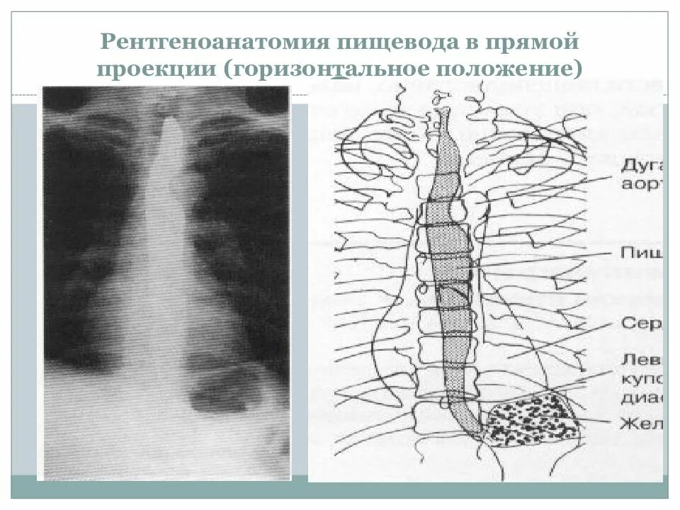 Поверхность пищевода