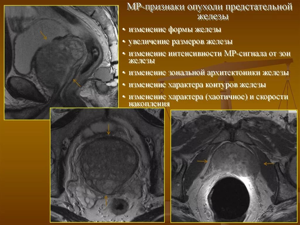 Начальные мр признаки