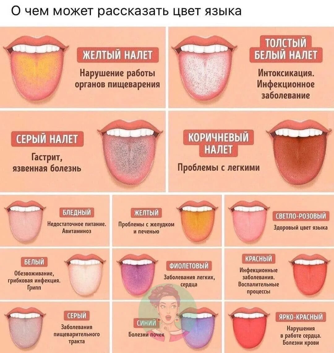 Как определить больной орган. По цвету языка определить болезни. Цвет языка о чем говорит.