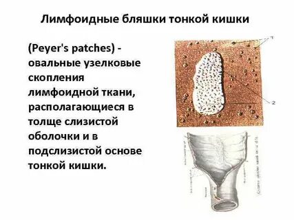 Скопление лимфоидной ткани