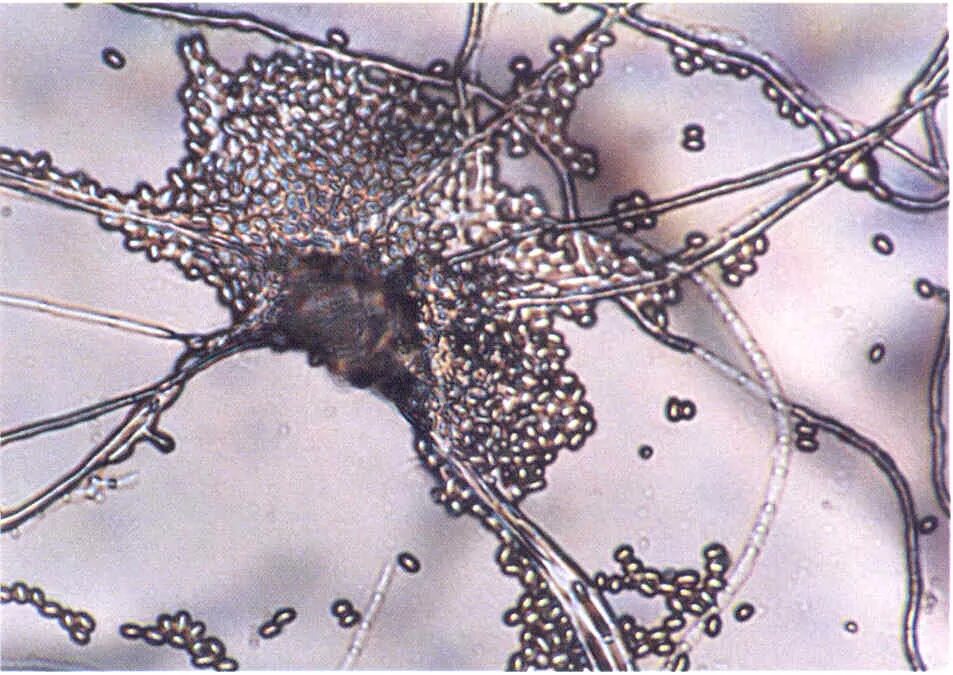 Trichophyton микроскопия. Мицелий грибов микроскопия. Мицелий грибов кожи микроскопия. Поверхностная трихофития микроскопия. Мицелий грибов на коже