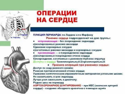 Пункция перикарда