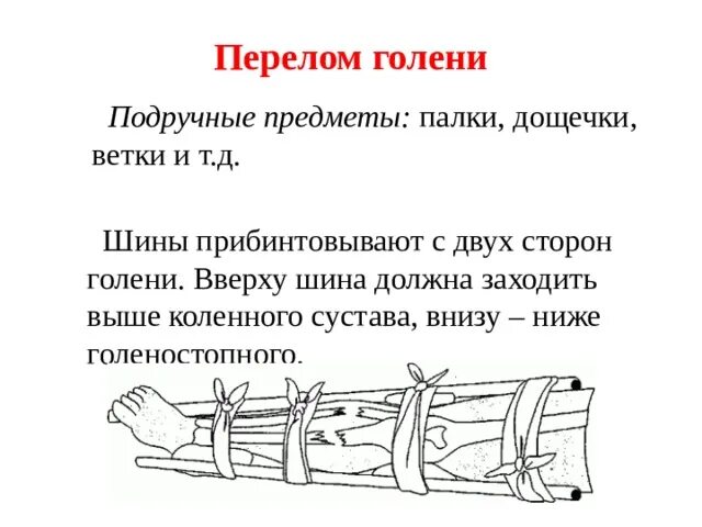 Перелом голени транспортировка. Иммобилизация при переломе голени. Носилки из стропы схема. Способы иммобилизации и переноски пострадавшего. Шина при переломе голени.