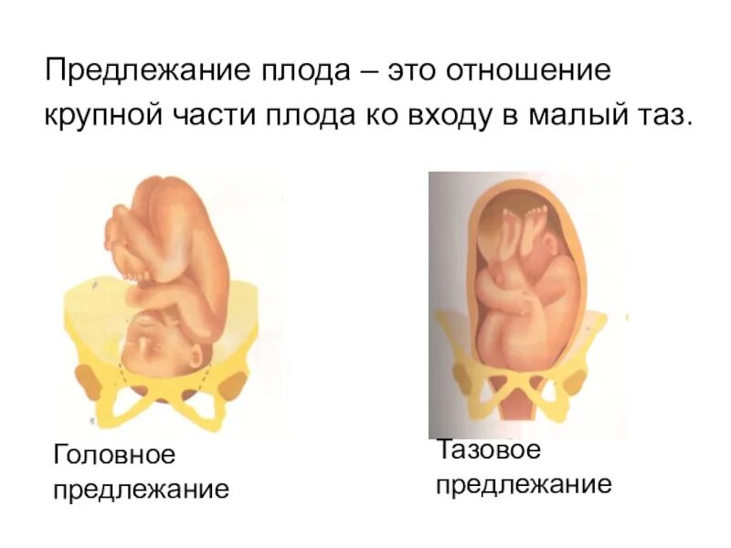 Предлежание плода 32 недели. Головное предлежание плода. Продольное головное предлежание плода. Головное предлежание плода на 32 неделе.