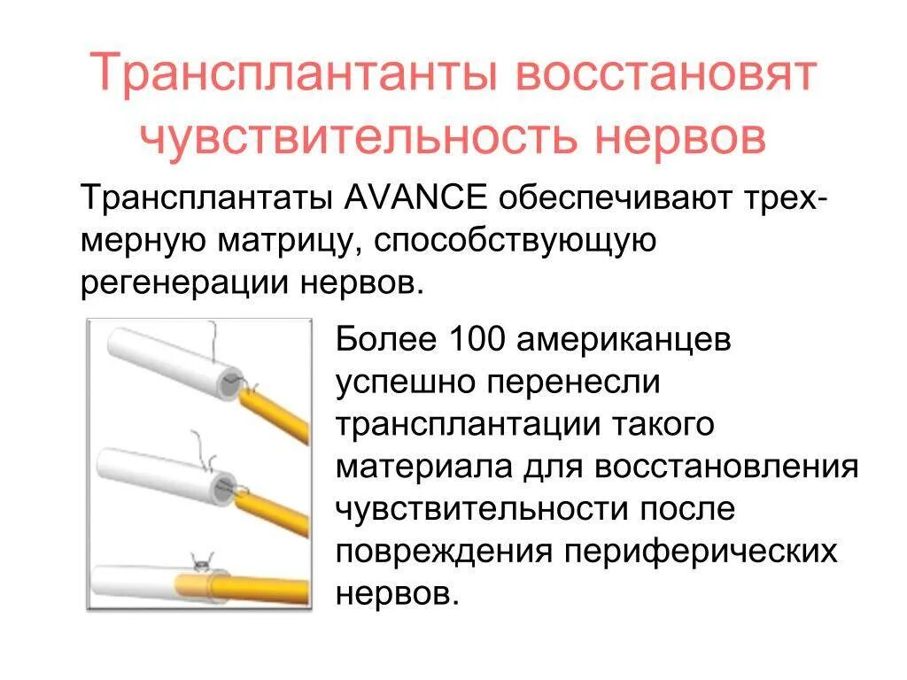 Восстановление периферических нервов. Восстановление периферических нервов препараты. Регенерация периферических нервов. Регенерация нерва после повреждения. Восстановление нервов после операции