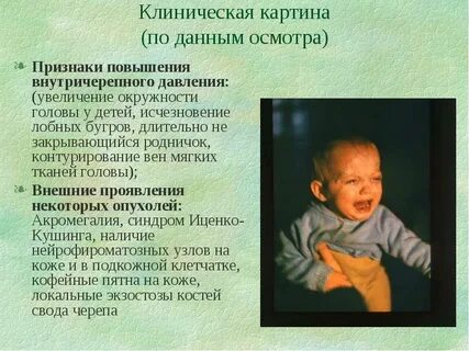 Симптомы повышенного давления у детей