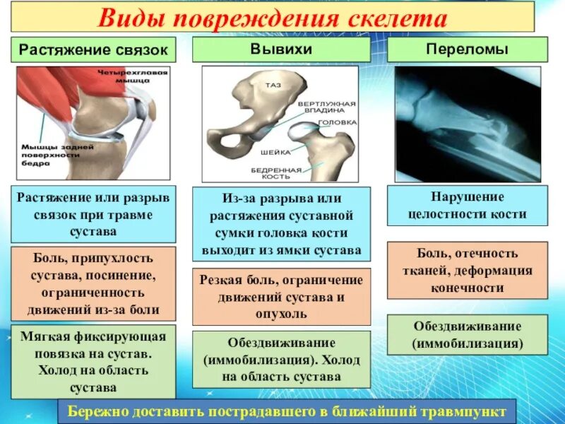 Суставы 1 типа
