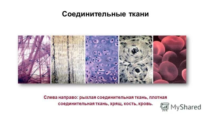 Соединительная ткань симптомы. Соединительная ткань симптомы