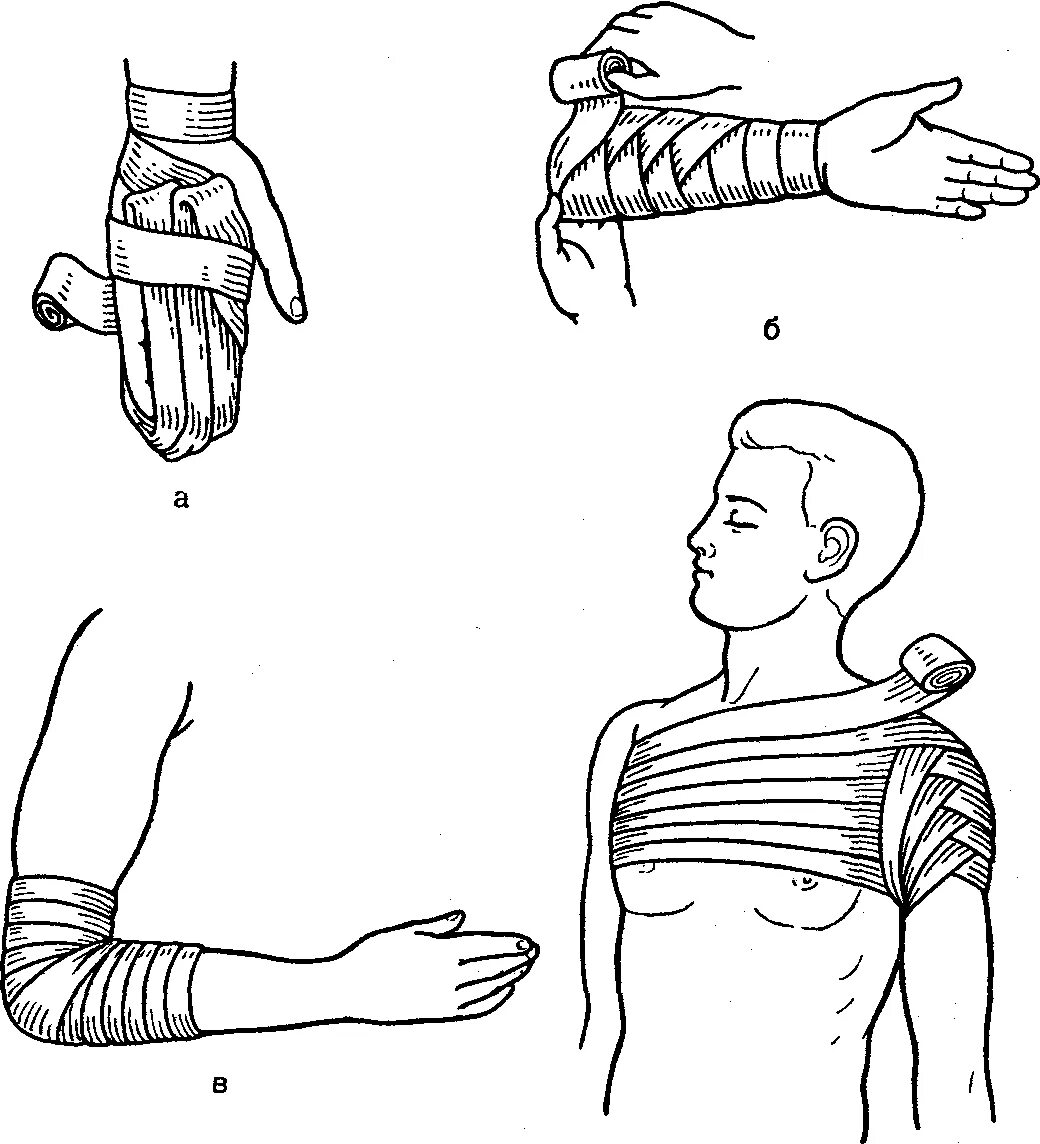 Бинтовая повязка алгоритм. Десмургия бинтовые повязки. Десмургия спиральная повязка. Десмургия повязки сходящаяся на локтевой сустав. Повязки на туловище десмургия.
