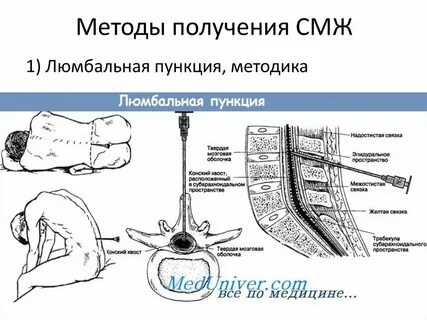 Выделение после пункции