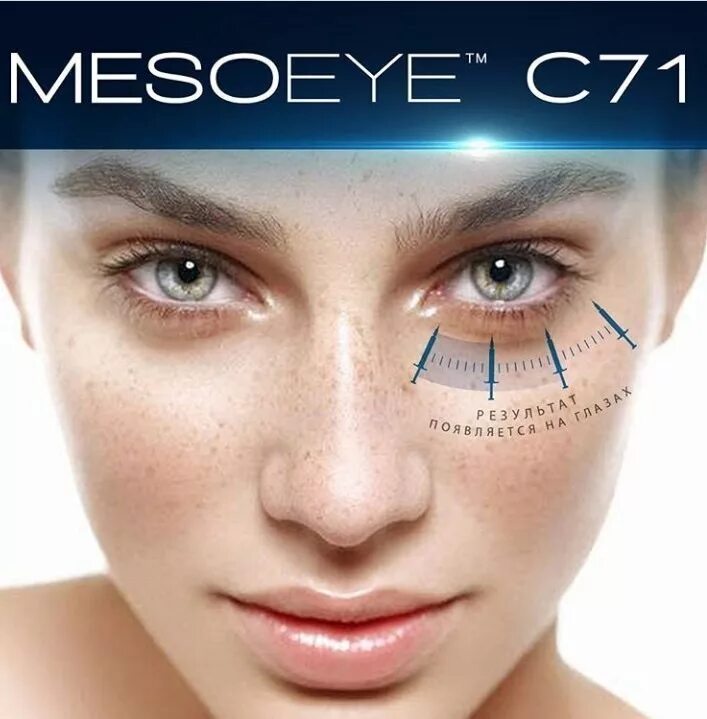 Мезо глаза отзывы. Мезоайс с 71. MESOEYE с71 (1мл). Мезотерапия MESOEYE c71. Биоревитализация МЕЗОАЙ.