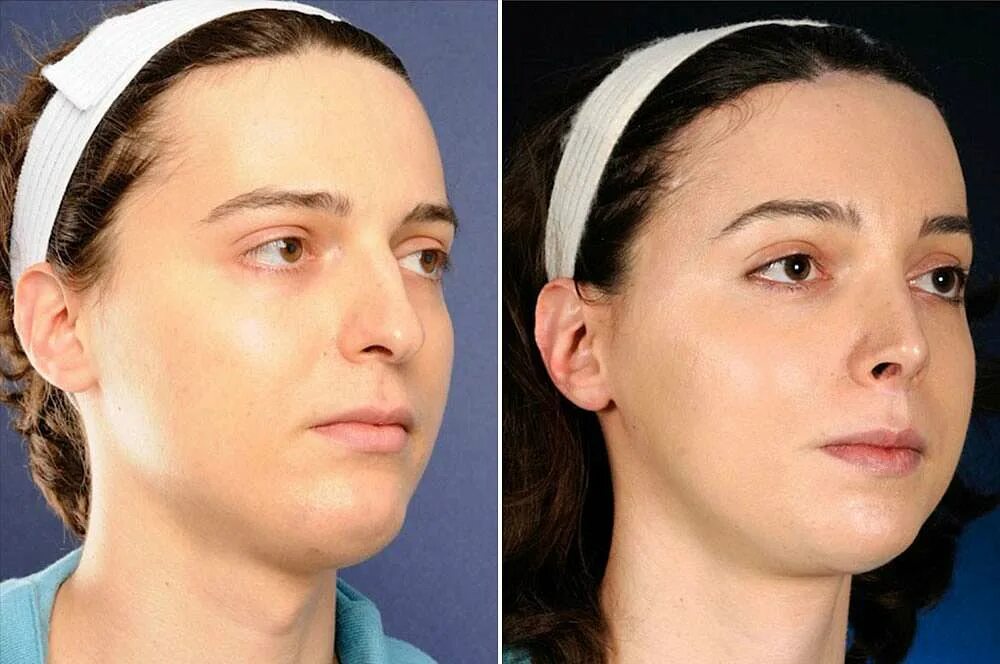 Где делать пластическую операцию