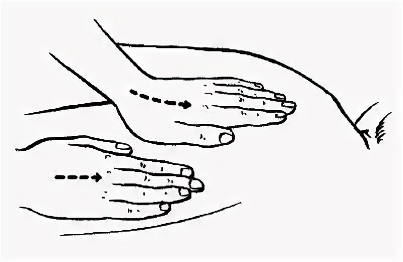 Приемы массажа тест с ответами. Приемы поглаживания при ожирении. Массаж при апраксии. Раздельно-параллельное плоскостное поглаживание. Поглаживание ОС плоскостное схема.