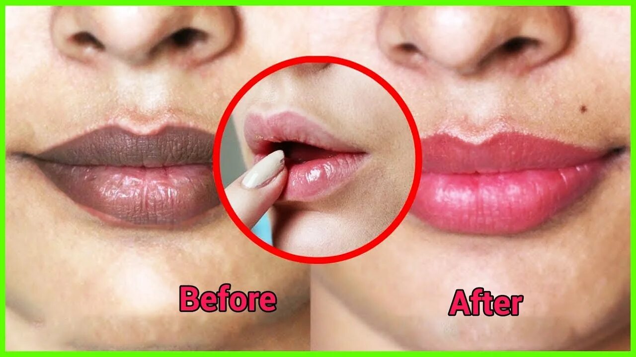 У гаврилы оттопырились губы и суженные глаза. У гаврилы оттопырились губы и суженные глаза. Хофманита 2022. Валя без макияжа. Исправление носа картошкой.