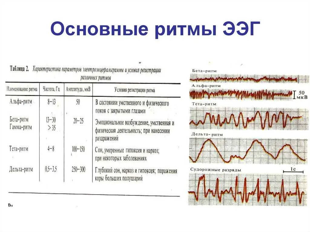 Диффузная активность мозга. Характеристика Альфа ритма на ЭЭГ. Амплитуда Альфа-ритма ЭЭГ В норме. Характеристика основных ритмов ЭЭГ. Электроэнцефалография (ЭЭГ) метод исследования.