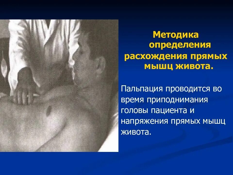 Пальпация живота. Пропедевтика осмотр пациента педиатрия. Пальпация печени пропедевтика. Пальпация желудка шум плеска.