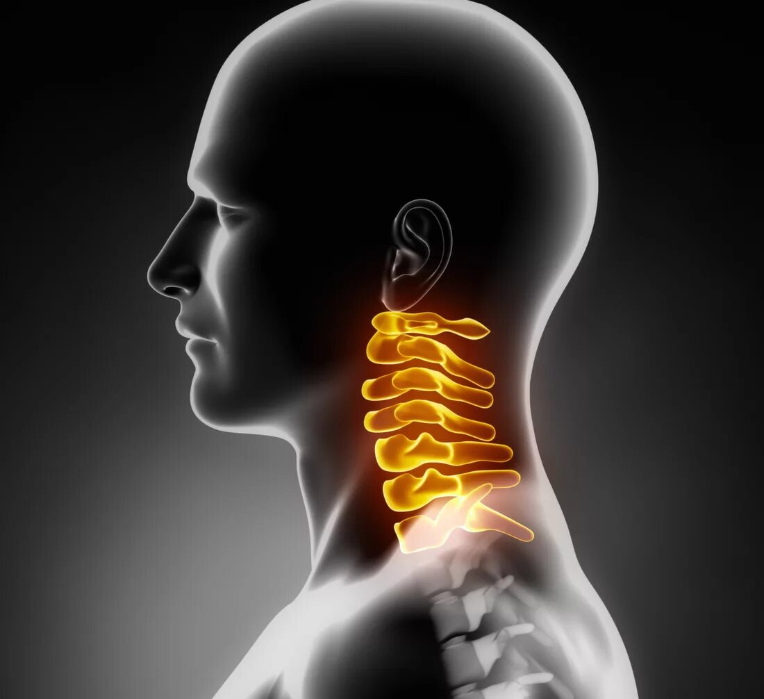 Упражнения для хруста шеи. Хруст позвоночника. Шейный остеохондроз хруст в шее. Хрустит шейный отдел. Хрустит шейный отдел.