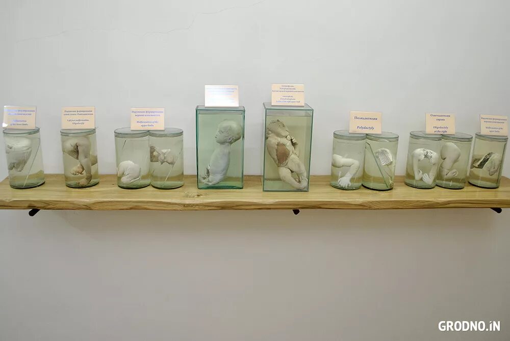 гродненская кунсткамера гродно. анатомическая экспозиция «гродненская кунсткамера».