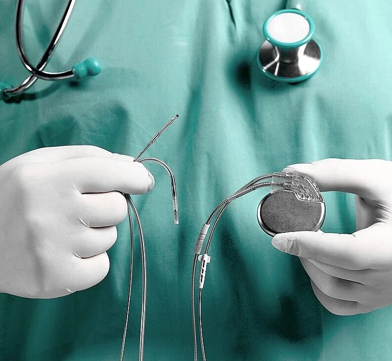 Если стоит кардиостимулятор можно. Имплантируемые кардиовертеры-дефибрилляторы. Имплантация кардиовертера-дефибриллятора. Имплантируемый кардиовертер-дефибриллятор. Кардиостимулятор Pacemaker.