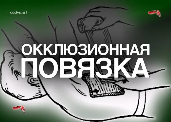 Техника наложения окклюзионной. Техника наложения окклюзионной повязки алгоритм. Окклюзионная пластырь. Наложение окклюзионной (герметизирующей) повязки. Показания для наложения окклюзионной повязки.