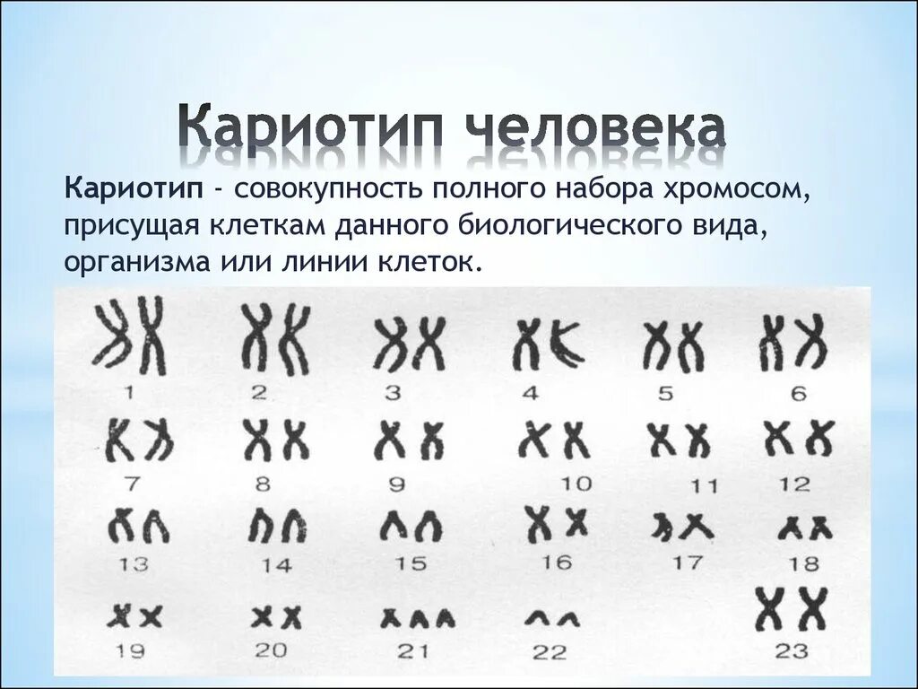 Кариотип человека определяют. Нормальный кариотип человека 46 хромосом. Кариотип человека 10 Klass. Хромосомная карта кариотип. Структура кариотипа человека.