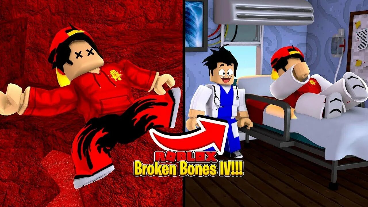 Break bones 4