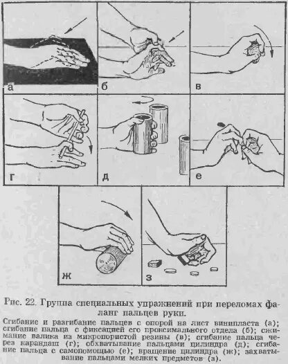 Лечебная физкультура после перелома лучевой кости со смещением. Восстанавливающие упражнения после перелома лучезапястной кости. ЛФК при переломе фаланги пальца. Упражнения для разрабатывания руки после перелома.