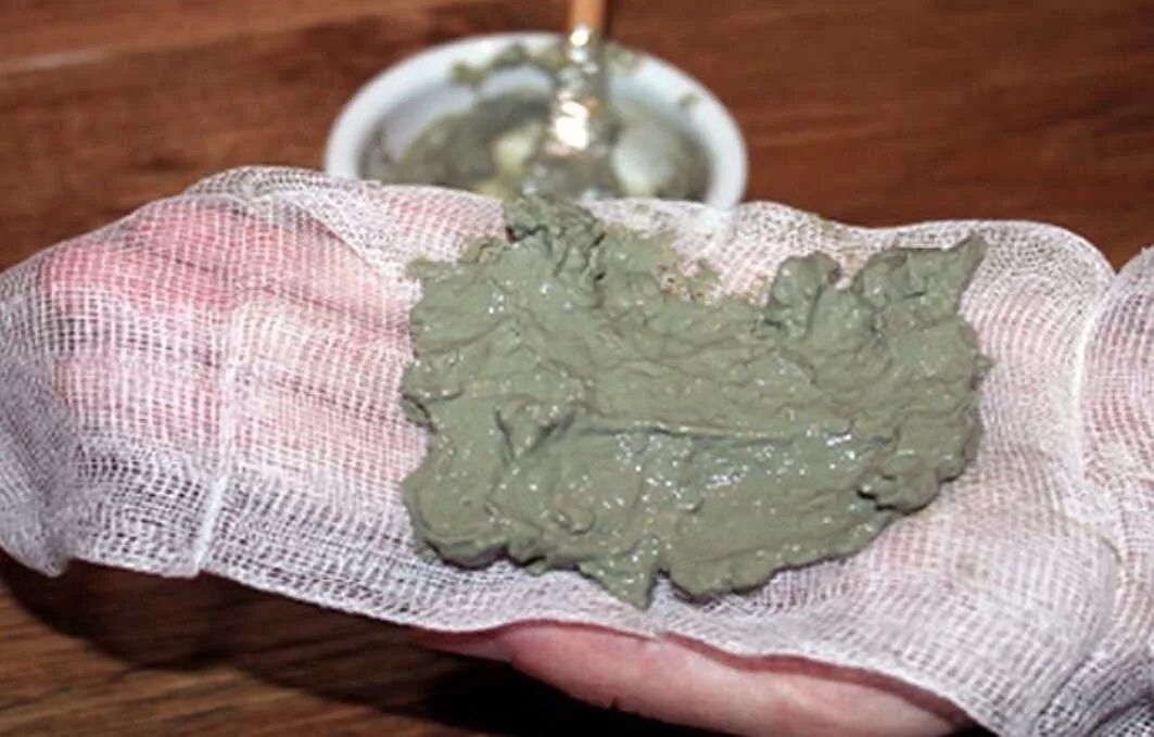 глина народные средства. компресс из голубой глины на нос. голубая глина компрессы. компресс из глины для суставов. голубая глина компрессы.