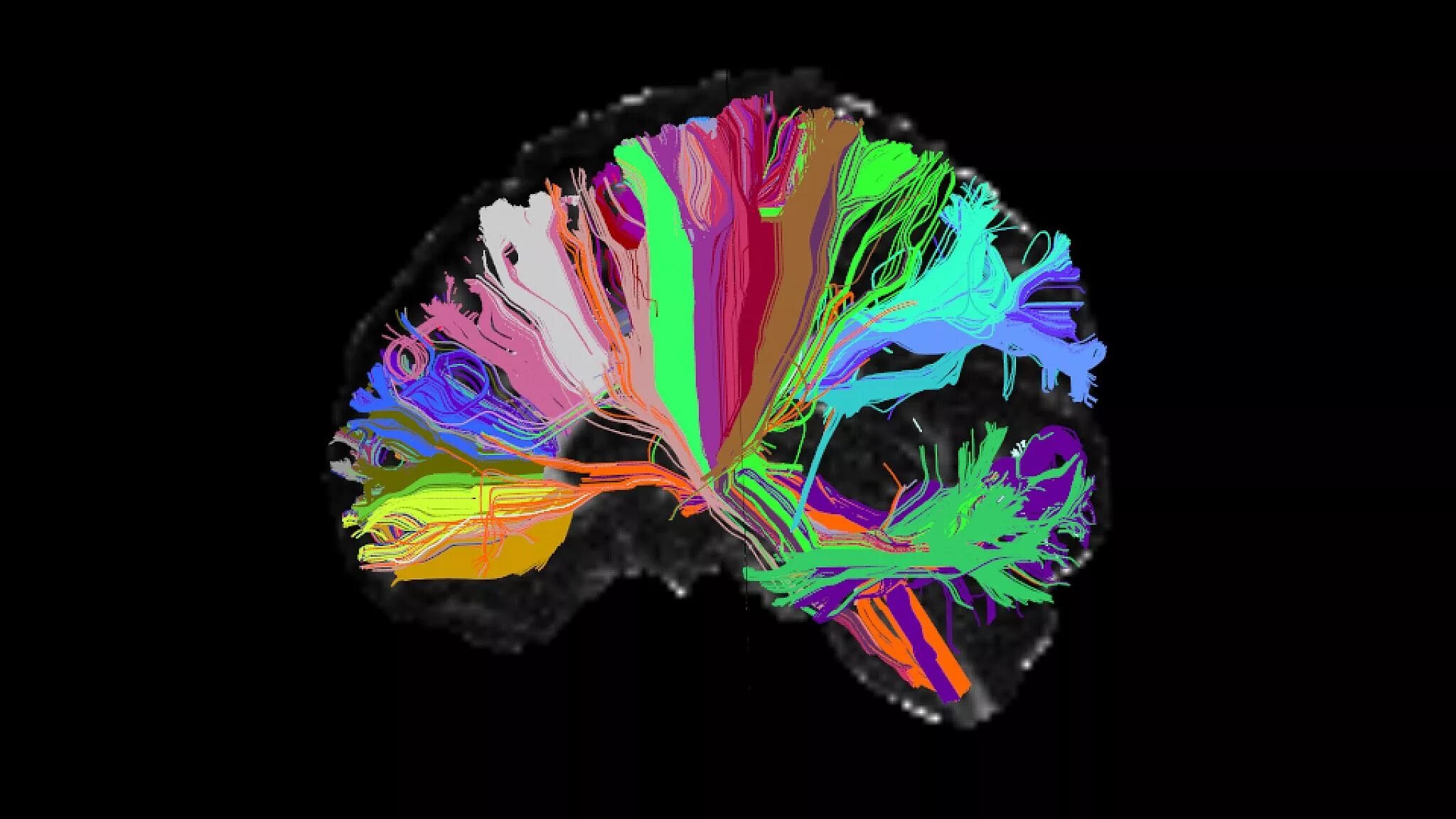 Colored brains