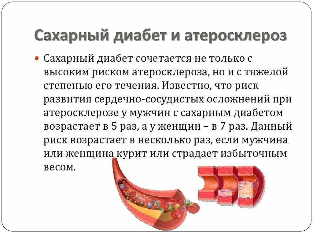 Диабетический атеросклероз. Механизм развития атеросклероза при сахарном диабете. факторы, способствующие развитию атеросклероза при сахарном диабете. атеросклероз и сахарный диабет. причины развития атеросклероза при сахарном диабете.