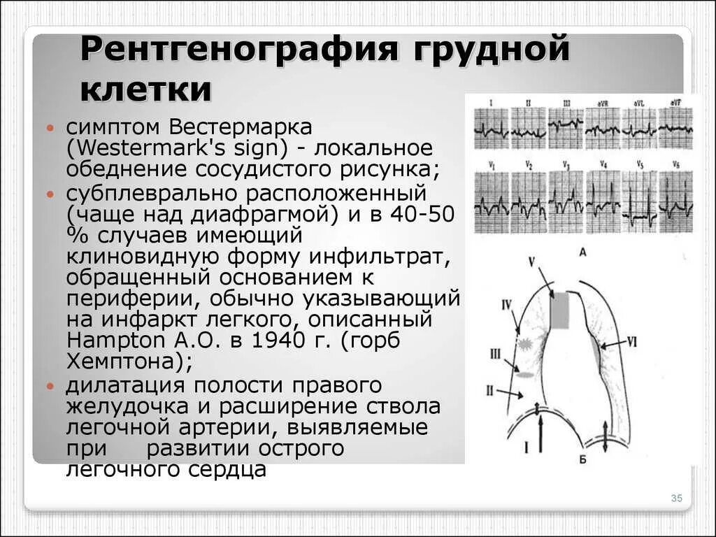 Рентген грудной клетки сколько раз можно делать. Рентген грудной клетки расшифровка снимков. рентген органов грудной клетки норма расшифровка. расшифровка рентген снимка грудной клетки. расшифровка рентгена грудной клетки норма.