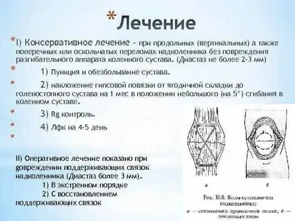 Вывих надколенника клинические рекомендации тесты нмо